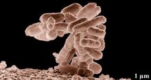 <font style='color:#000000'>Gut bacteria may increase obesity risk</font>